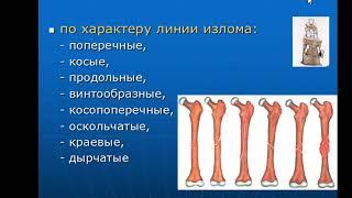 9:50-11:20  Переломы, классификация Клиника, диагностика,лечение