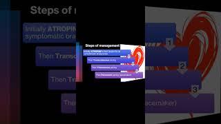 Management of AV heart Block. #doctor #cardio #cardiology #diagnosis #heart #messi
