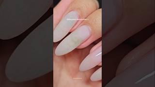 greenies journey ️ #pseudomonas #greenies #nailfail