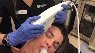 What is Ultherapy + How Does it Work? Nashville Aesthetic Provider