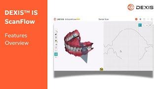 DEXIS™ IS ScanFlow 1.0.11 Overview