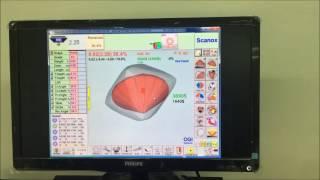 Mark Pique in OGI Systems in Scanox Marker