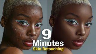 High-End Skin Retouching in 9 Minutes For Beginners | Frequency Separation Photoshop Tutorial