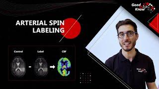 Good To Know - Arterial Spin Labeling (ASL)