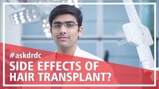 What is a hair transplant & side effects of hair transplant | HairMD, Pune