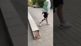 бионический протез бедра Genium Ottobock