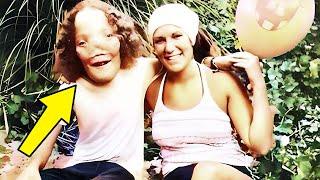 Remember Rocky Dennis, The Boy Who Inspired 'Mask'? This Is What Happened To Him!