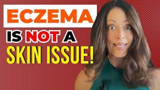 Eczema and the Gut | Getting to the Root Causes