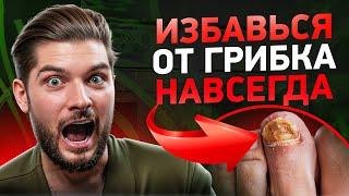 ТОП-1 причина грибка ногтей + лучшее средство от грибка!