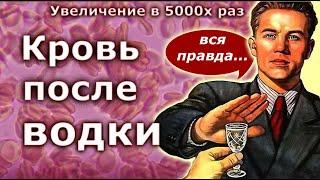 Кровь после водки - вся правда