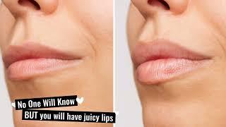 Let's talk about filler!