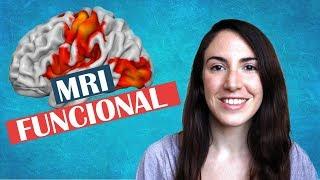 Resonancia magnética funcional para estudiar el funcionamiento del cerebro humano
