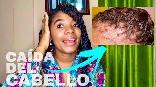 CAÍDA DEL CABELLO AFRORIZADO| Consejos