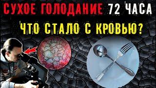 Сухое голодание 72 часа (3 дня). Что стало с кровью под микроскопом?