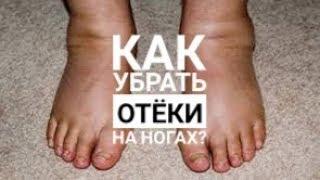 Как убрать отёки на ногах? Домашние способы и аптечные мази от отёков.