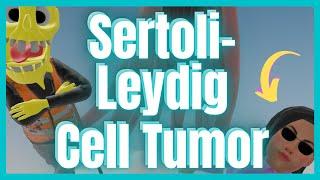 Seroli-Leydig Cell Tumor (Mnemonic for the USMLE)