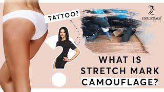 All About Stretch Mark Camouflage | Stretch Mark Camouflage Online Course