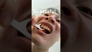 Dentist Reveals How You Are FLOSSING WRONG! 