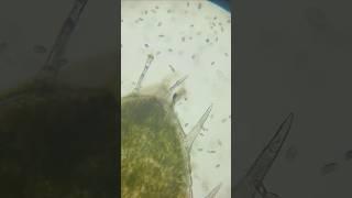 It has EVOLVED! #microorganism  #microbiology #paramecium #smallworlds