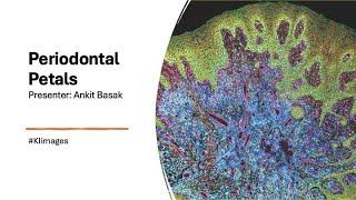 2025 Image Awards Lightning Talks - Periodontal Petals