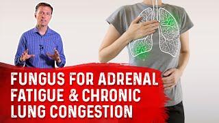 Cordyceps Fungus: The Amazing Remedy for Adrenal Fatigue & Chronic Lung Congestion – Dr. Berg