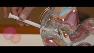 BoriCap Boric Acid Suppository Applicator Tutorial