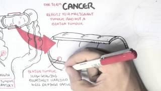 Cancer - Introduction I