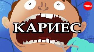 ЧТО ВЫЗЫВАЕТ КАРИЕС??? / TED ED НА РУССКОМ ЯЗЫКЕ