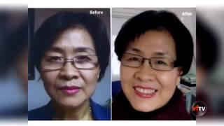 Cell Cutis Anti-Aging Regeneration Anti-Aging Whitening Anti-Aging Anti-Wrinkle Anti-Aging Skin