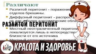 Разлитой перитонит