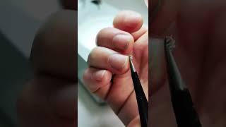 Worms in nails science research we should cut our nails 