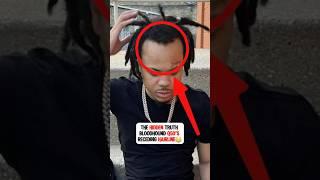 The Hidden Truth Behind Bloodhound Q50’s Receding Hairline #bloodhoundq50 ￼
