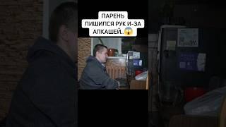 Парень в 16 лет лишился рук..