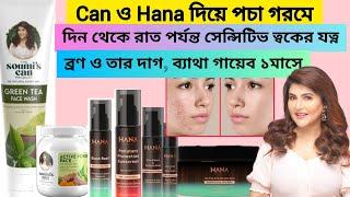 Soumi's Can & Hana Beauty দিয়ে Summer Skin Care Routine For Sensitive Skin To Get Acne Free Skin