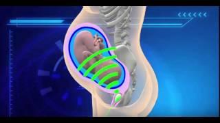 INSTITUT MARQUÈS - Babypod 3d - News Direct