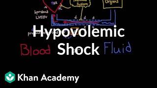 Hypovolemic shock | Circulatory System and Disease | NCLEX-RN | Khan Academy