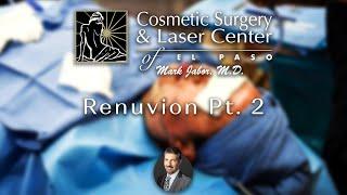 Renuvion Pt. 2 - Cosmetic Surgery and Laser Center of El Paso | Dr. Mark Jabor