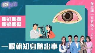 健康關注組 ｜ 眼紅眼黃眼綠眼藍 一眼就知身體出事 ｜ HOY TV 77台 ｜ 郭田葰 ｜ 黃芳雯 ｜ 林曉蕙 ｜ 第38集