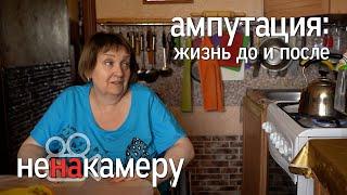 Ампутация: жизнь до и после. Потеряв ногу, учитель продолжила работать дальше