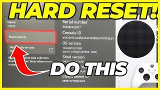 Fixing Xbox Series X/S Internet Wi-Fi Connection Issues (Easy Method) 2025