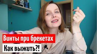 Брекеты минивинты отзыв / надкусочные пломбы трут  / винты для брекетов стоимость