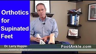 The Supinated Foot – Orthotic Treatment | Seattle Podiatrist Larry Huppin