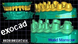 exocad freamwork peek                Walid Mansour 00201005587414 Cairo.Egypt