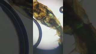 A new discovery!! #microorganism #biology #crustacean #creepy