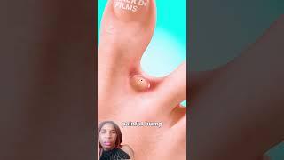 Extraordinary Mosquito #life#story #reaction #shortsv viral #credit:@zackdfilms