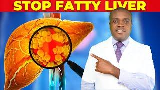 8 Worst Foods For Fatty Liver And Insulin Resistance