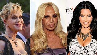 Unrecognizable: The Shocking Before-And-Afters Of Celebrity Surgery.