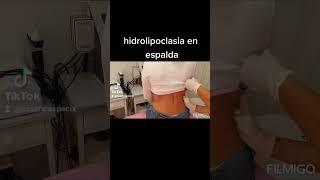 LIPO SIN CIRUGIA