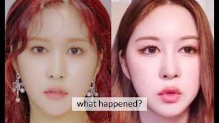 COSMIC GIRLS (WJSN) PLASTIC SURGERY ANALYSIS PT 2