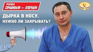 Можно ли закрыть дырку в носу? Перфорация перегородки носа